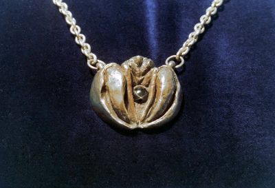 Krebs (Silber mit eingelegtem Sterndiopsid, 5 x 4,5 cm, 1993)